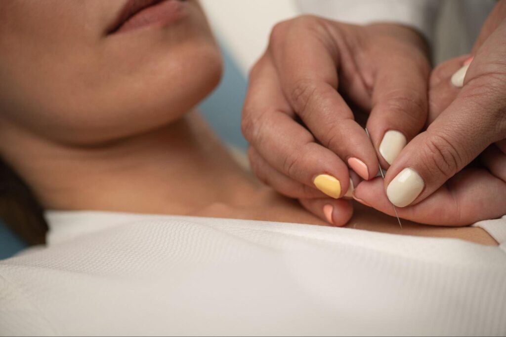 Woman with painted nails administering a needle into a woman for acupuncture. 