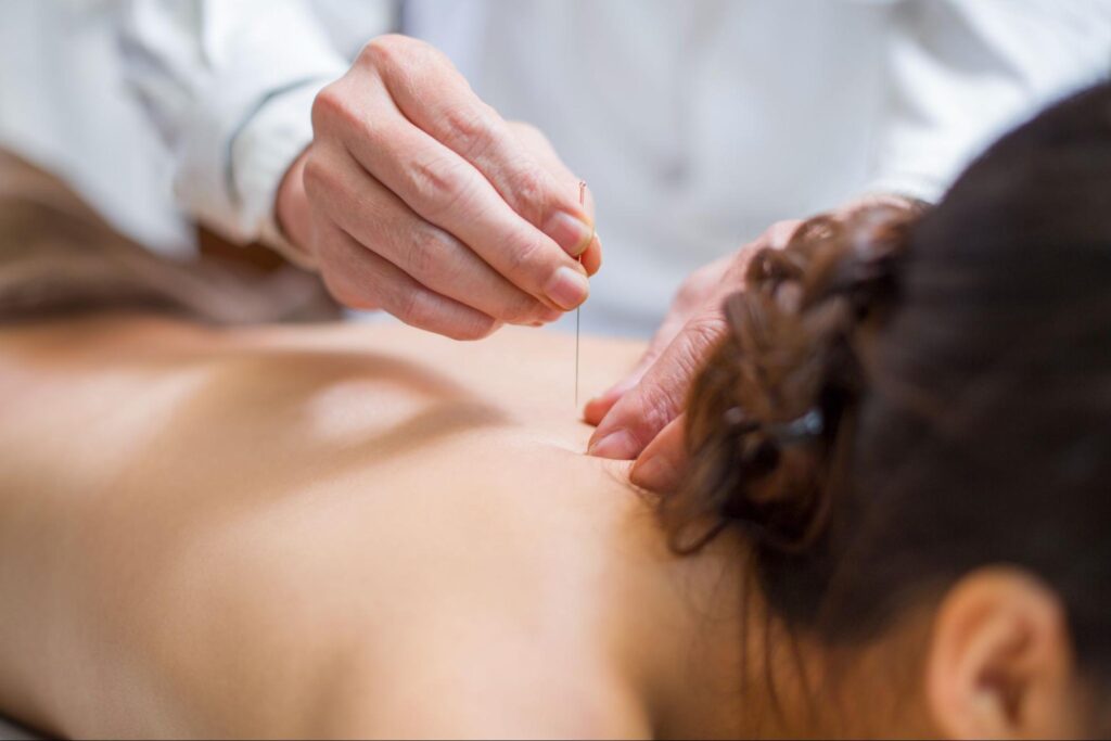 Does Acupuncture Hurt?